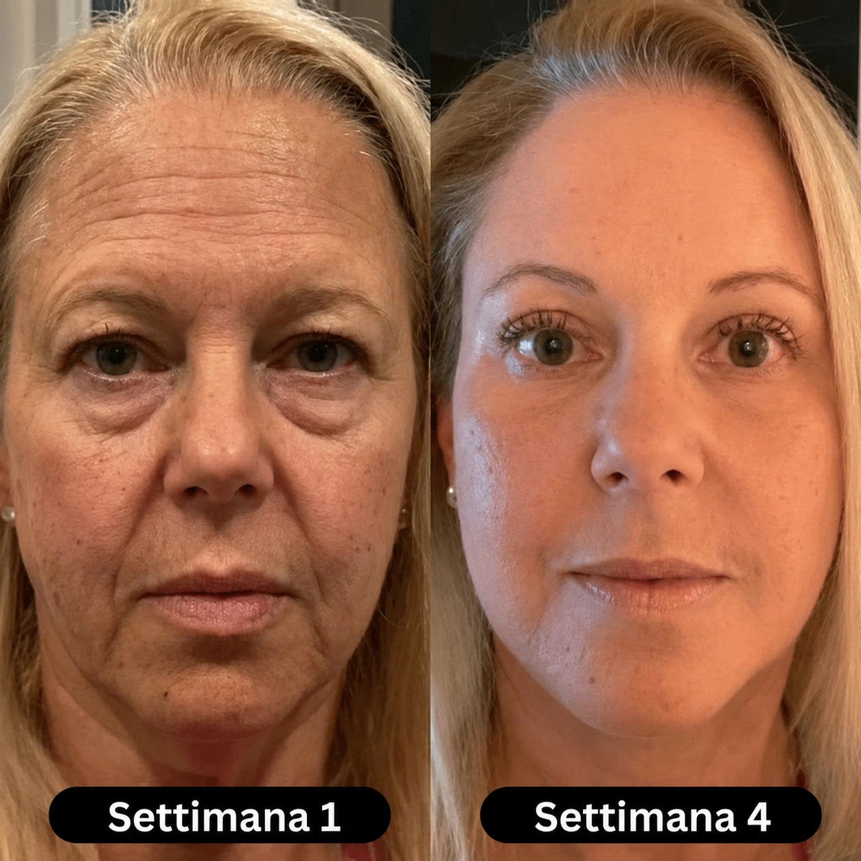 Siero al collagene coreano per pelli mature