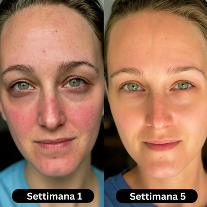 Siero al collagene coreano per pelli mature