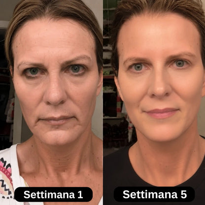 Siero al collagene coreano per pelli mature